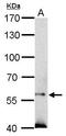 Suppressor of cytokine signaling 5 antibody, TA308762, Origene, Western Blot image 