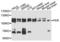 FER Tyrosine Kinase antibody, LS-B15570, Lifespan Biosciences, Western Blot image 