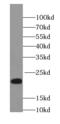 Neurocalcin Delta antibody, FNab05573, FineTest, Western Blot image 