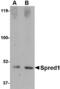 Sprouty Related EVH1 Domain Containing 1 antibody, MBS151347, MyBioSource, Western Blot image 