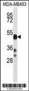 Cytochrome P450 Family 2 Subfamily D Member 6 antibody, TA324552, Origene, Western Blot image 