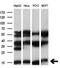 Synaptojanin-2-binding protein antibody, M11249, Boster Biological Technology, Western Blot image 