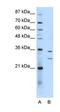 Ribosome Production Factor 1 Homolog antibody, orb324925, Biorbyt, Western Blot image 