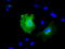 Kelch Repeat And BTB Domain Containing 7 antibody, TA501391, Origene, Immunofluorescence image 