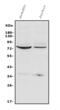 NADPH oxidase 5 antibody, A03119, Boster Biological Technology, Western Blot image 
