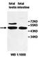 Zinc Finger Protein 200 antibody, orb78017, Biorbyt, Western Blot image 