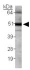 Calreticulin antibody, GTX20004, GeneTex, Western Blot image 