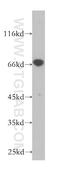 CTP Synthase 1 antibody, 15914-1-AP, Proteintech Group, Western Blot image 