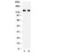 Leptin Receptor antibody, R30991, NSJ Bioreagents, Western Blot image 