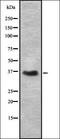 Deleted in azoospermia-like antibody, orb337108, Biorbyt, Western Blot image 