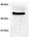 Peptidyl-prolyl cis-trans isomerase D antibody, GTX79245, GeneTex, Western Blot image 