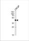 Mitochondrial Fission Regulator 2 antibody, TA328187, Origene, Western Blot image 