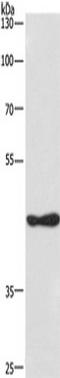 Casein kinase I isoform delta antibody, TA349833, Origene, Western Blot image 