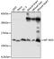 Mitochondrially Encoded NADH:Ubiquinone Oxidoreductase Core Subunit 3 antibody, 18-176, ProSci, Western Blot image 