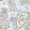Glutathione S-transferase A2 antibody, A7678, ABclonal Technology, Immunohistochemistry paraffin image 
