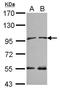 N-alpha-acetyltransferase 15, NatA auxiliary subunit antibody, LS-C155444, Lifespan Biosciences, Western Blot image 
