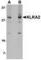 A0FK58 antibody, PA5-20687, Invitrogen Antibodies, Western Blot image 
