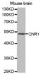 Cannabinoid Receptor 1 antibody, abx001241, Abbexa, Western Blot image 