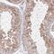 Centriolin antibody, HPA020468, Atlas Antibodies, Immunohistochemistry frozen image 