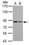 VPS35 Retromer Complex Component antibody, GTX116260, GeneTex, Western Blot image 