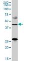 Zinc Finger DHHC-Type Containing 11 antibody, H00079844-B01P, Novus Biologicals, Western Blot image 