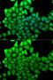mRNA-capping enzyme antibody, GTX54686, GeneTex, Immunocytochemistry image 