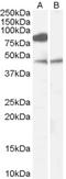 Zinc Finger DHHC-Type Containing 8 antibody, orb19438, Biorbyt, Western Blot image 