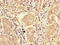 Cyclin-dependent kinase 4 inhibitor B antibody, orb23122, Biorbyt, Immunohistochemistry paraffin image 