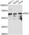Pescadillo homolog antibody, LS-C749508, Lifespan Biosciences, Western Blot image 