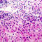 Cystatin E/M antibody, GTX55260, GeneTex, Immunohistochemistry paraffin image 