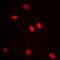 Adenosine Deaminase RNA Specific B1 antibody, orb213524, Biorbyt, Immunofluorescence image 