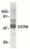 C-C Motif Chemokine Receptor 8 antibody, PA5-19911, Invitrogen Antibodies, Western Blot image 
