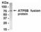 ATP Synthase F1 Subunit Beta antibody, XW-8124, ProSci, Western Blot image 