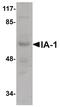 INSM Transcriptional Repressor 1 antibody, PA5-20823, Invitrogen Antibodies, Western Blot image 