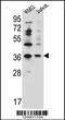 Putative protein phosphatase 1 regulatory inhibitor subunit 3G antibody, 56-162, ProSci, Western Blot image 