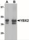 Y-Box Binding Protein 2 antibody, NBP1-76283, Novus Biologicals, Western Blot image 