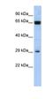 Chromosome 6 Open Reading Frame 223 antibody, orb326011, Biorbyt, Western Blot image 