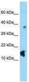 Natriuretic Peptide C antibody, TA344667, Origene, Western Blot image 