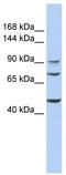 Polypeptide N-Acetylgalactosaminyltransferase 5 antibody, TA341942, Origene, Western Blot image 