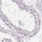 FKBP Prolyl Isomerase 10 antibody, NBP2-38905, Novus Biologicals, Immunohistochemistry frozen image 