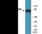Ribosomal Protein S6 Kinase A1 antibody, EKC2101, Boster Biological Technology, Western Blot image 
