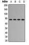 Forkhead Box O1 antibody, LS-C368599, Lifespan Biosciences, Western Blot image 