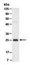 Glutathione-Disulfide Reductase antibody, orb66674, Biorbyt, Western Blot image 