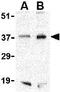 HAP antibody, GTX31736, GeneTex, Western Blot image 