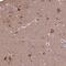 SPRY Domain Containing 3 antibody, HPA039685, Atlas Antibodies, Immunohistochemistry frozen image 