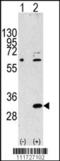 Eukaryotic Translation Initiation Factor 4E Family Member 2 antibody, TA302039, Origene, Western Blot image 