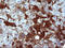 Serpin Family B Member 3 antibody, LS-C338251, Lifespan Biosciences, Immunohistochemistry paraffin image 