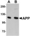 Amyloid Beta Precursor Protein antibody, TA306769, Origene, Western Blot image 