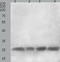 C-Type Lectin Domain Family 4 Member A antibody, TA321849, Origene, Western Blot image 