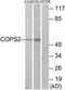 COP9 Signalosome Subunit 2 antibody, TA312140, Origene, Western Blot image 